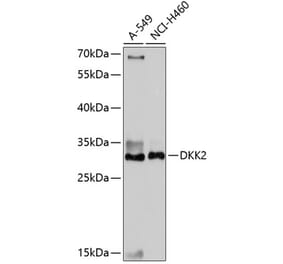 Western Blot - Anti-DKK2 Antibody (A89140) - Antibodies.com
