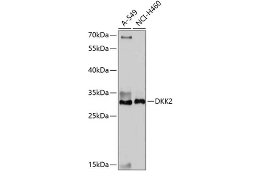 Western Blot - Anti-DKK2 Antibody (A89140) - Antibodies.com