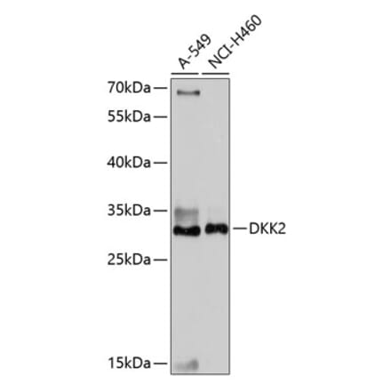 Western Blot - Anti-DKK2 Antibody (A89140) - Antibodies.com