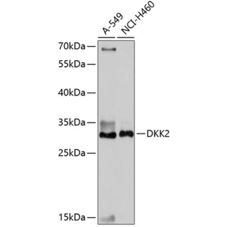 Western Blot - Anti-DKK2 Antibody (A89140) - Antibodies.com