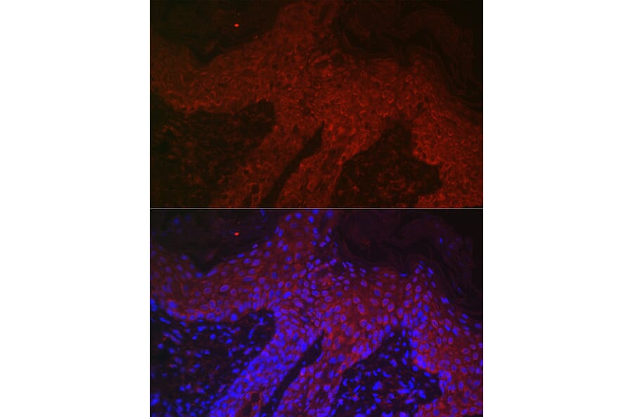 Immunofluorescence - Anti-DKK2 Antibody (A89140) - Antibodies.com