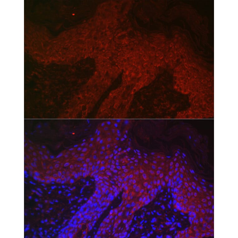 Immunofluorescence - Anti-DKK2 Antibody (A89140) - Antibodies.com