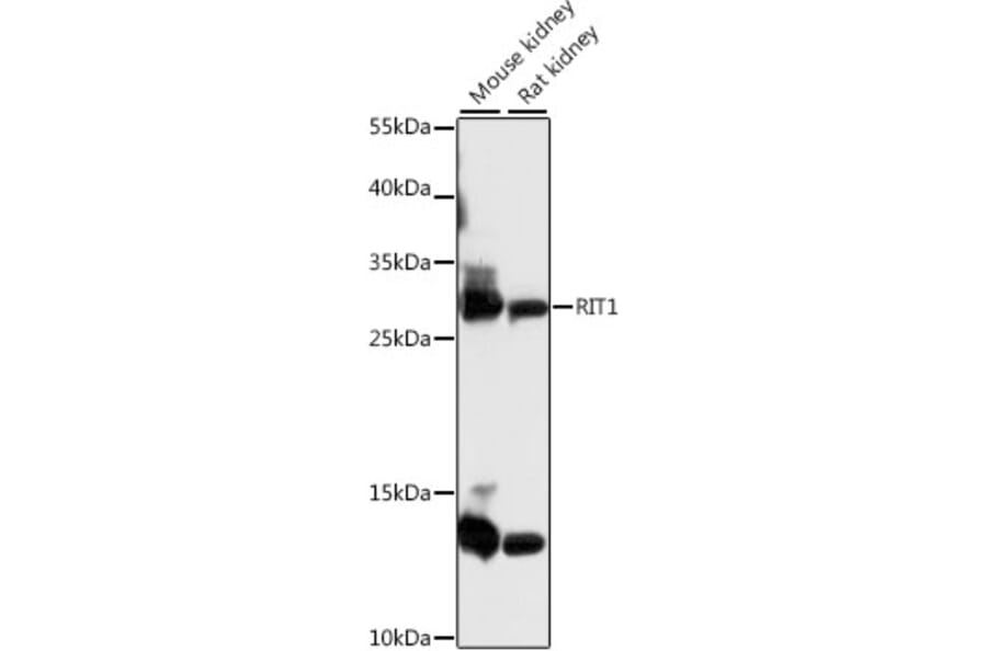 Western Blot - Anti-RIT1/RIT Antibody (A89141) - Antibodies.com