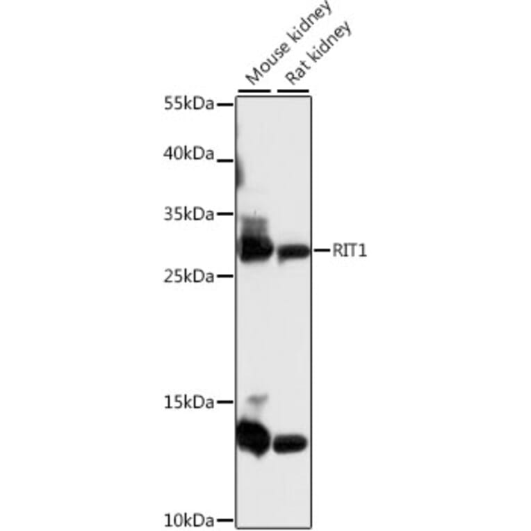 Western Blot - Anti-RIT1/RIT Antibody (A89141) - Antibodies.com