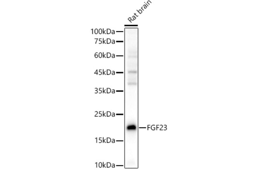 Western Blot - Anti-FGF 23 Antibody (A89142) - Antibodies.com
