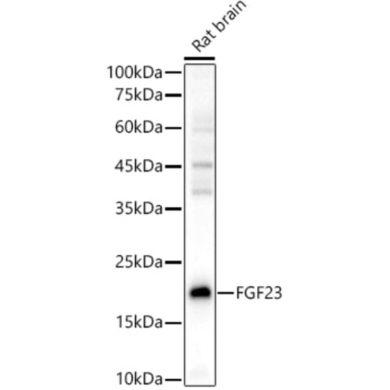 Western Blot - Anti-FGF 23 Antibody (A89142) - Antibodies.com