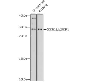Western Blot - Anti-p27 KIP 1 Antibody (A89143) - Antibodies.com