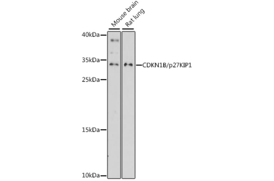 Western Blot - Anti-p27 KIP 1 Antibody (A89143) - Antibodies.com