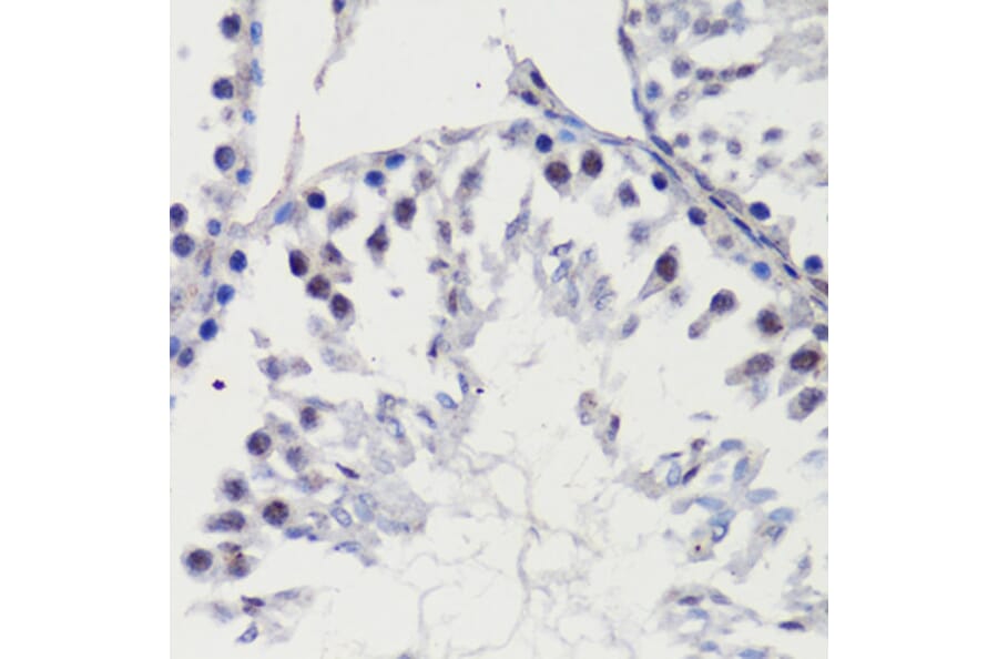 Immunohistochemistry - Anti-p27 KIP 1 Antibody (A89143) - Antibodies.com
