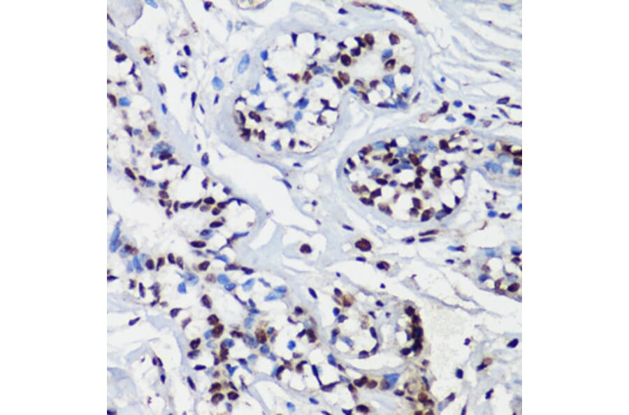 Immunohistochemistry - Anti-p27 KIP 1 Antibody (A89143) - Antibodies.com