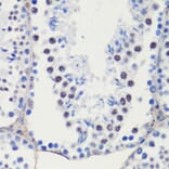 Immunohistochemistry - Anti-p27 KIP 1 Antibody (A89143) - Antibodies.com