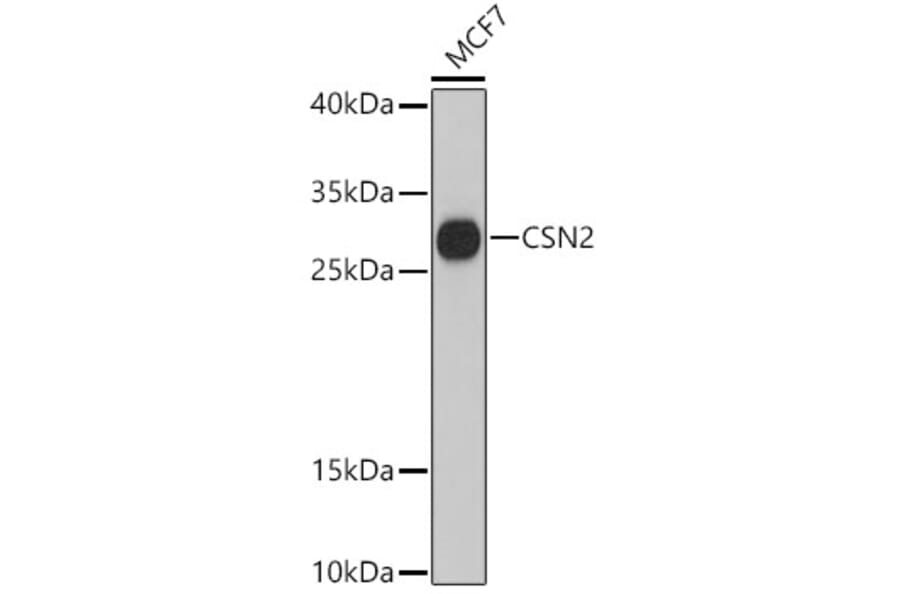Western Blot - Anti-beta Casein Antibody (A89144) - Antibodies.com