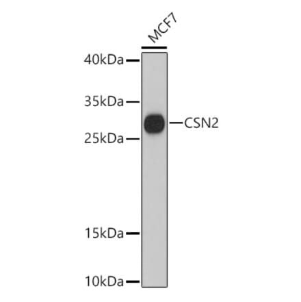 Western Blot - Anti-beta Casein Antibody (A89144) - Antibodies.com