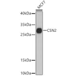 Western Blot - Anti-beta Casein Antibody (A89144) - Antibodies.com