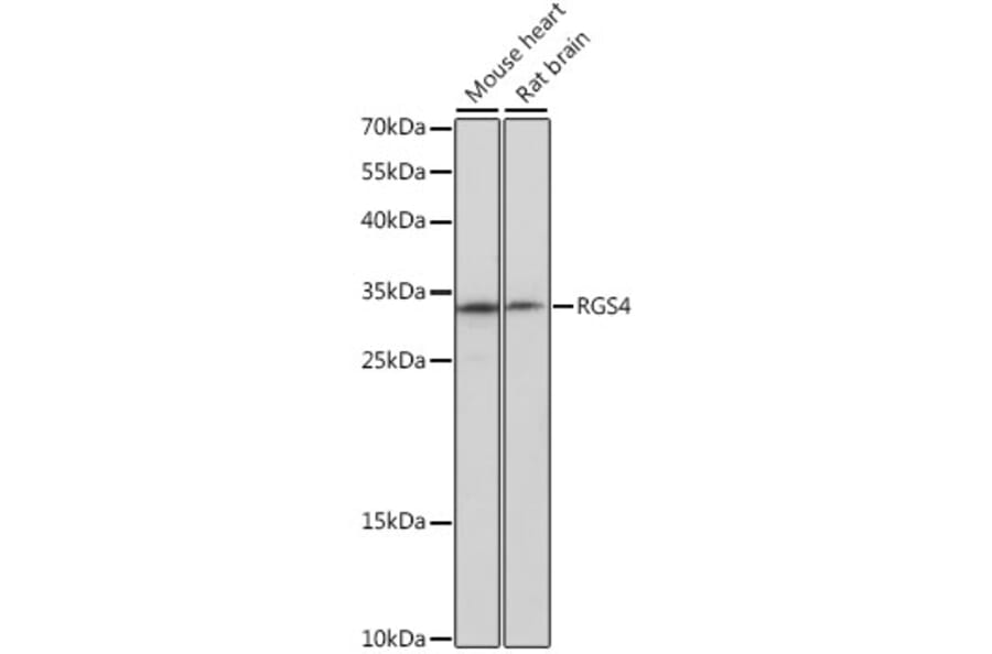 Western Blot - Anti-RGS4 Antibody (A16423) - Antibodies.com