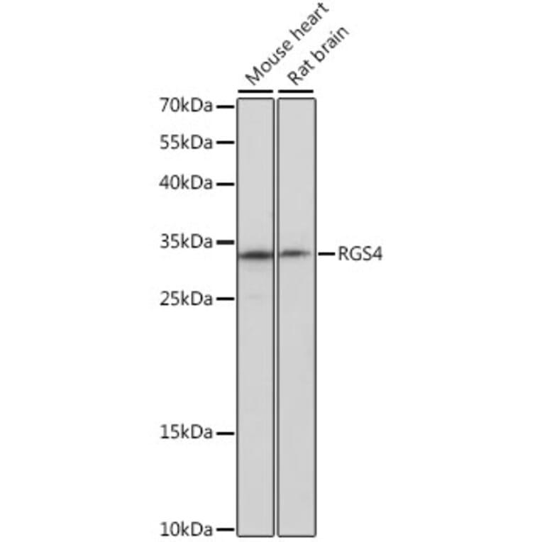 Western Blot - Anti-RGS4 Antibody (A16423) - Antibodies.com