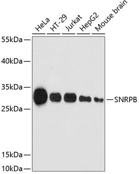 Western blot analysis of extracts of various cell lines, using Anti-SNRPB Antibody (A2009) at 1:3000 dilution.
Secondary antibody: Goat Anti-Rabbit IgG (H+L) (HRP) (AS014) at 1:10,000 dilution.
Lysates / proteins: 25µg per lane.
Blocking buffer: 3% non-fat dry milk in TBST.
Detection: ECL Enhanced Kit (RM00021).
Exposure time: 180s.