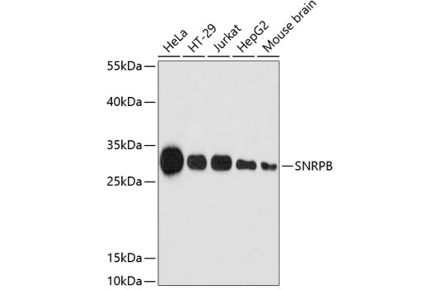Western Blot - Anti-SNRPB/SmB Antibody (A89146) - Antibodies.com