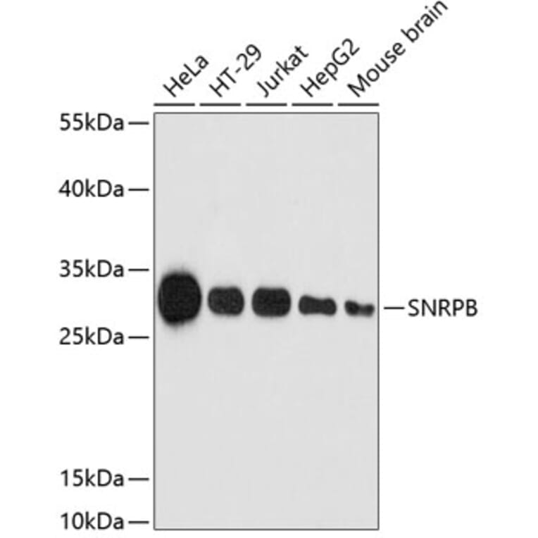Western Blot - Anti-SNRPB/SmB Antibody (A89146) - Antibodies.com