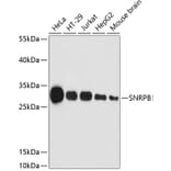 Western Blot - Anti-SNRPB/SmB Antibody (A89146) - Antibodies.com