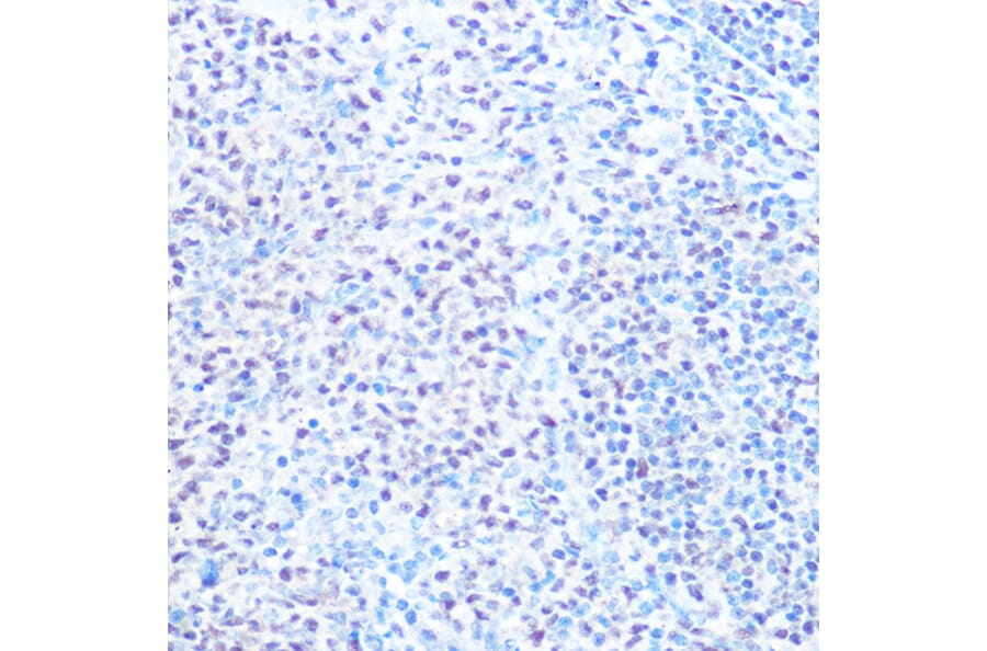 Immunohistochemistry - Anti-SNRPB/SmB Antibody (A89146) - Antibodies.com