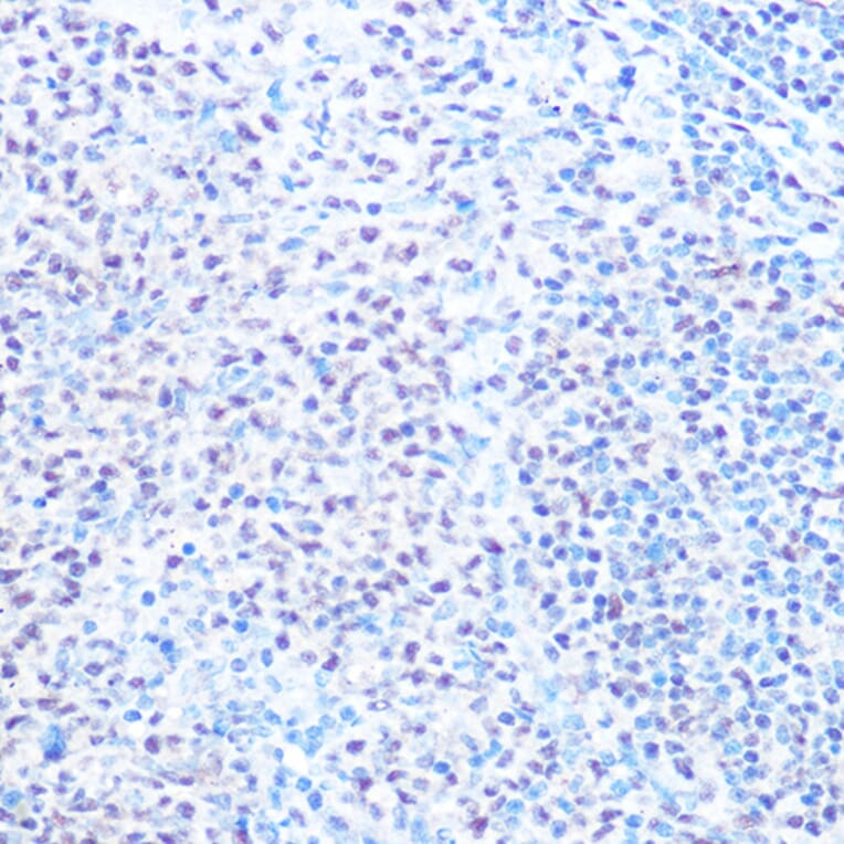 Immunohistochemistry - Anti-SNRPB/SmB Antibody (A89146) - Antibodies.com