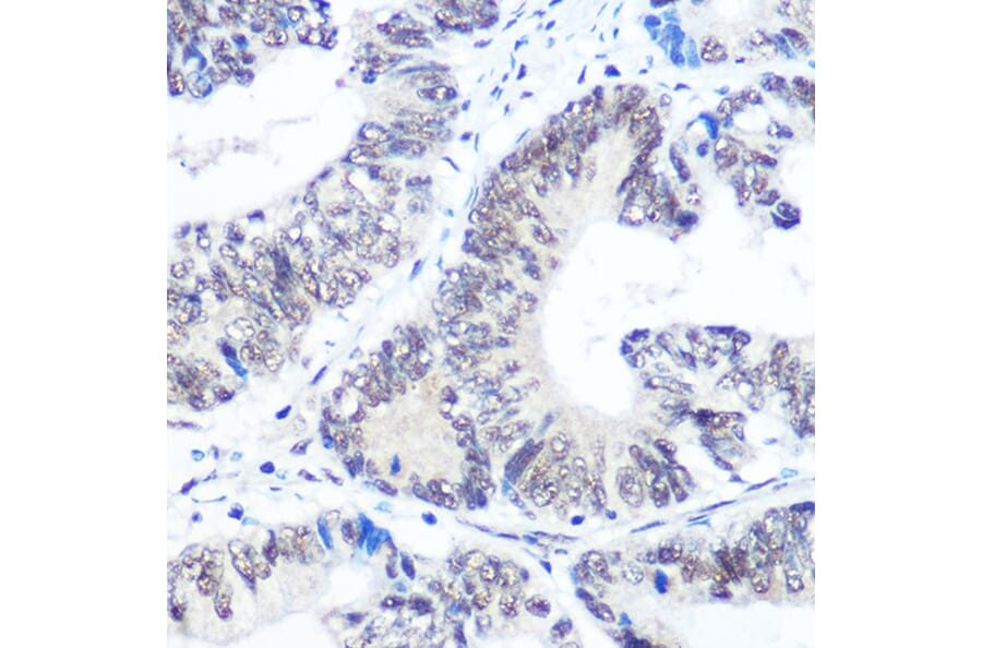 Immunohistochemistry - Anti-SNRPB/SmB Antibody (A89146) - Antibodies.com