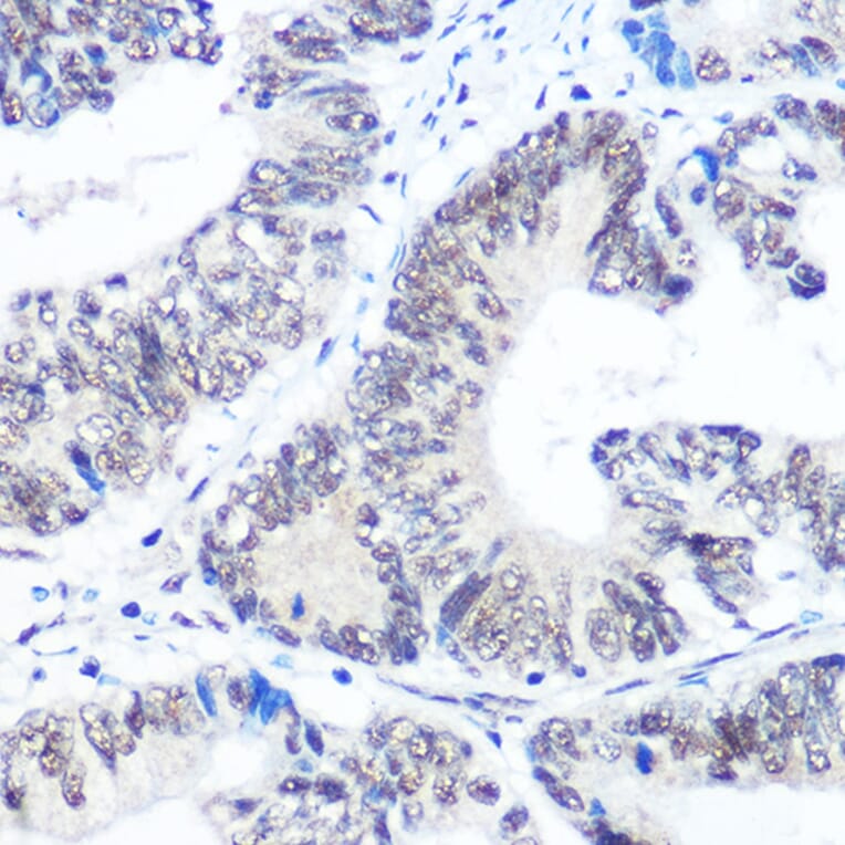Immunohistochemistry - Anti-SNRPB/SmB Antibody (A89146) - Antibodies.com