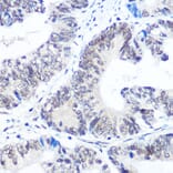 Immunohistochemistry - Anti-SNRPB/SmB Antibody (A89146) - Antibodies.com
