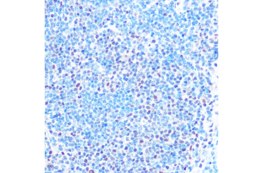Immunohistochemistry - Anti-SNRPB/SmB Antibody (A89146) - Antibodies.com