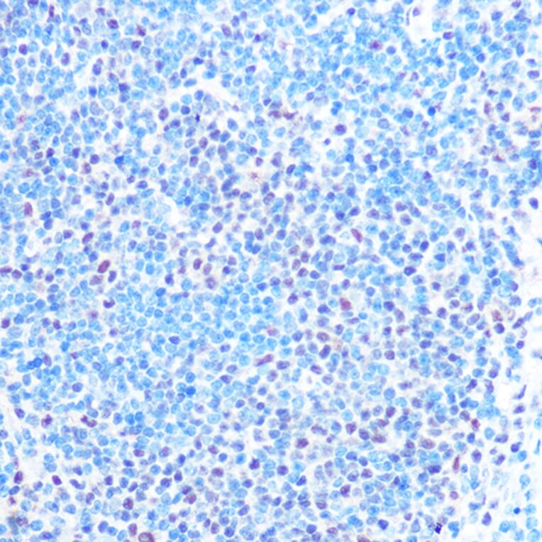 Immunohistochemistry - Anti-SNRPB/SmB Antibody (A89146) - Antibodies.com