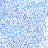 Immunohistochemistry - Anti-SNRPB/SmB Antibody (A89146) - Antibodies.com