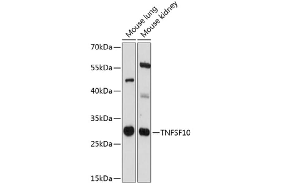 Western Blot - Anti-TRAIL Antibody (A89147) - Antibodies.com