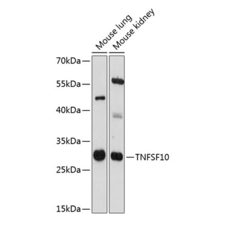 Western Blot - Anti-TRAIL Antibody (A89147) - Antibodies.com