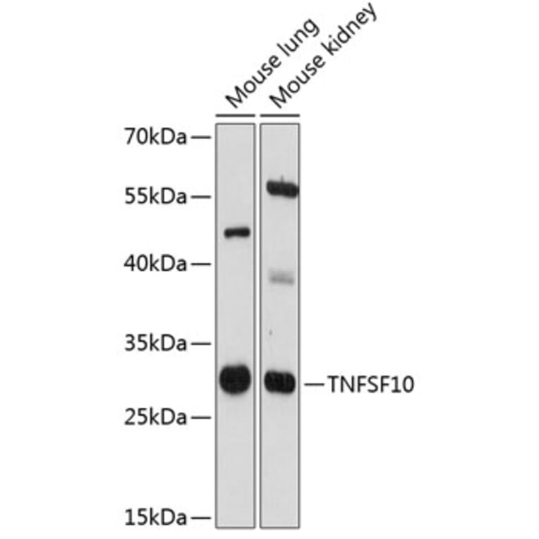 Western Blot - Anti-TRAIL Antibody (A89147) - Antibodies.com