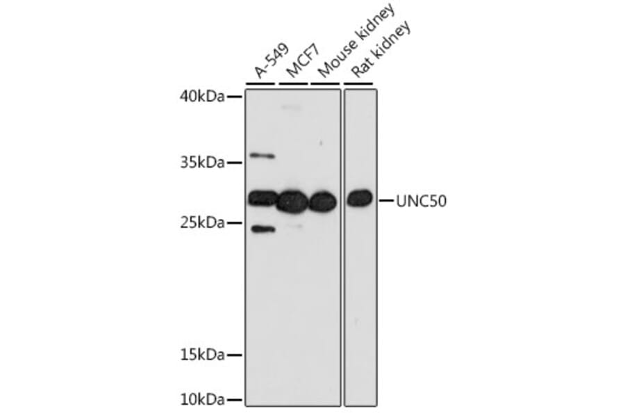 Western Blot - Anti-UNC50 Antibody (A89148) - Antibodies.com
