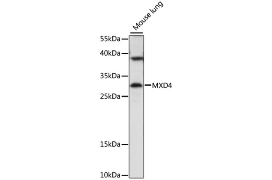 Western Blot - Anti-MXD4/MAD4 Antibody (A89149) - Antibodies.com