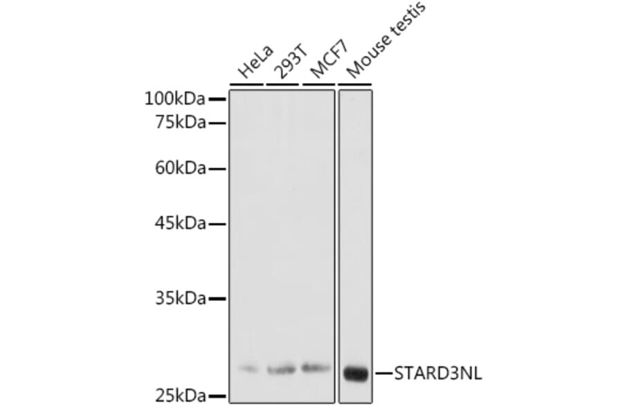 Western Blot - Anti-STARD3NL Antibody (A89150) - Antibodies.com