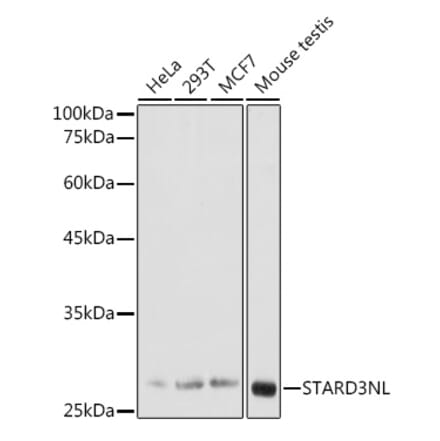 Western Blot - Anti-STARD3NL Antibody (A89150) - Antibodies.com