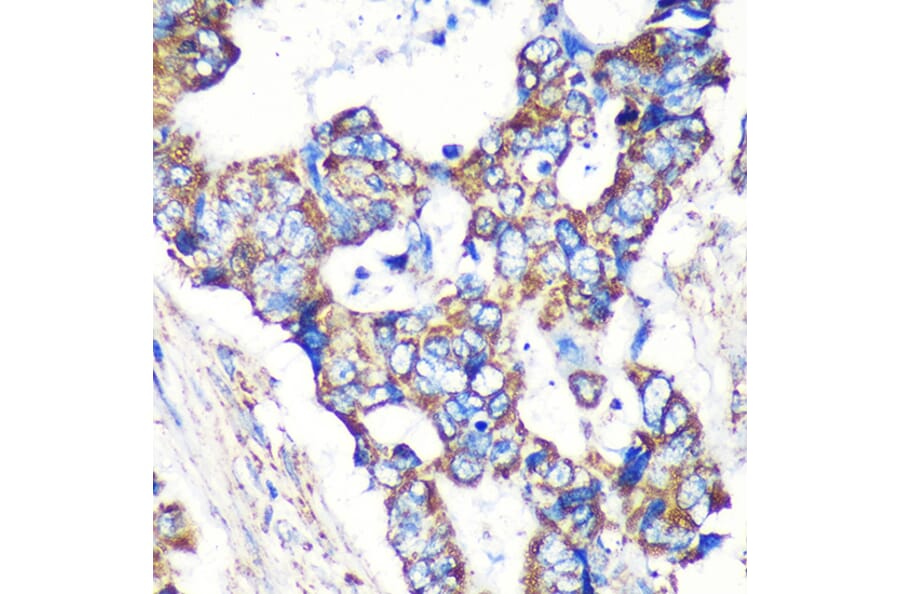 Immunohistochemistry - Anti-STARD3NL Antibody (A89150) - Antibodies.com