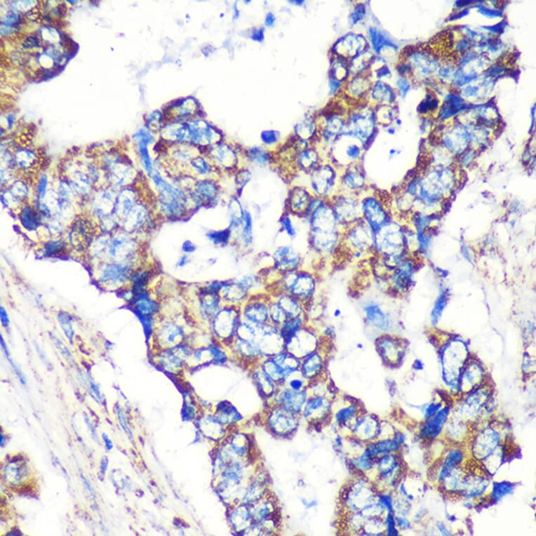 Immunohistochemistry - Anti-STARD3NL Antibody (A89150) - Antibodies.com