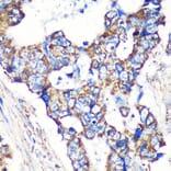 Immunohistochemistry - Anti-STARD3NL Antibody (A89150) - Antibodies.com