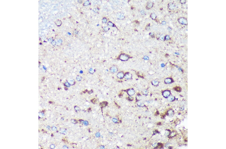 Immunohistochemistry - Anti-STARD3NL Antibody (A89150) - Antibodies.com