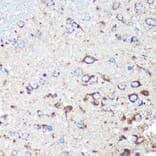 Immunohistochemistry - Anti-STARD3NL Antibody (A89150) - Antibodies.com