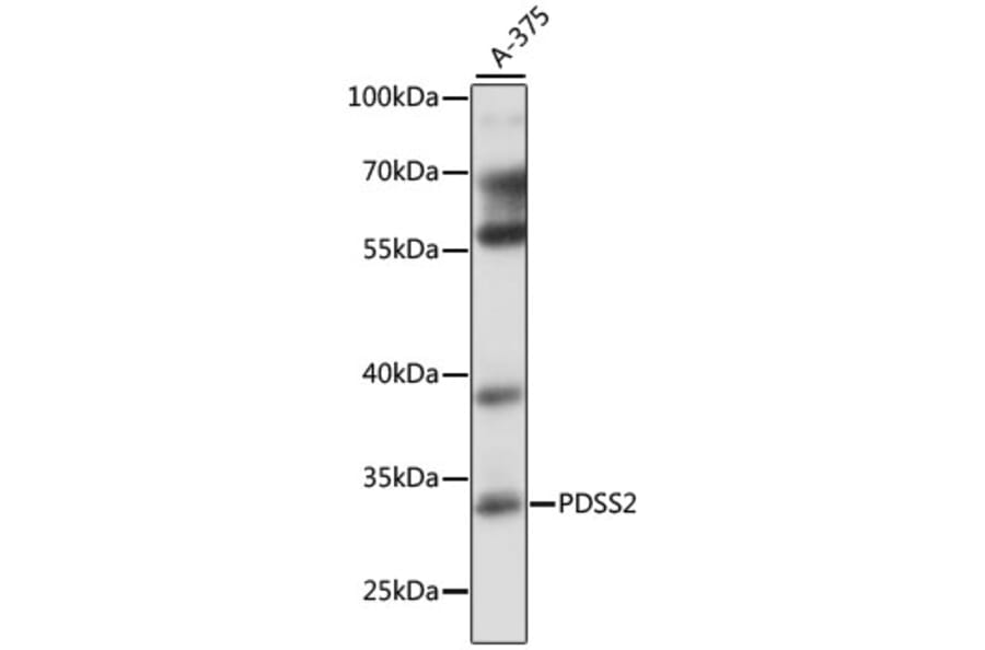 Western Blot - Anti-PDSS2 Antibody (A89151) - Antibodies.com