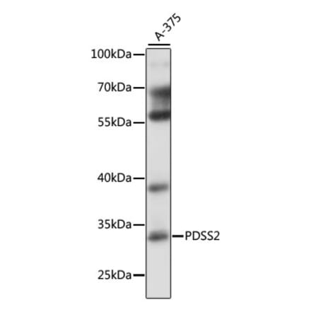 Western Blot - Anti-PDSS2 Antibody (A89151) - Antibodies.com