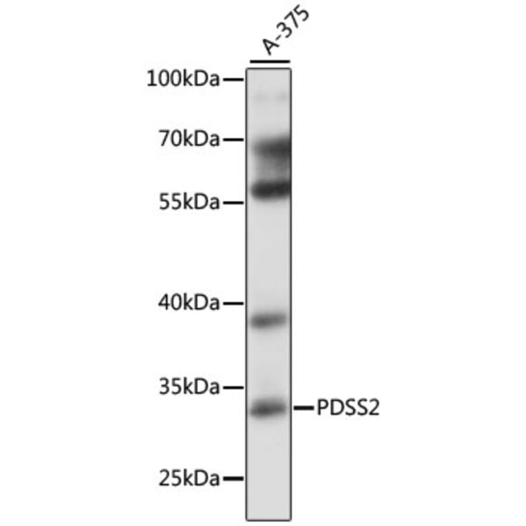Western Blot - Anti-PDSS2 Antibody (A89151) - Antibodies.com