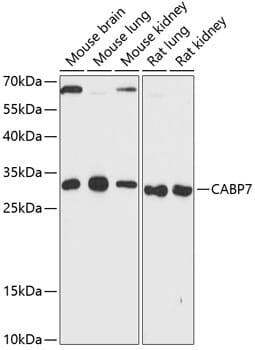 Western blot analysis of extracts of various cell lines, using Anti-CABP7 Antibody (A13703) at 1:3000 dilution.
Secondary antibody: Goat Anti-Rabbit IgG (H+L) (HRP) (AS014) at 1:10,000 dilution.
Lysates / proteins: 25µg per lane.
Blocking buffer: 3% non-fat dry milk in TBST.
Detection: ECL Enhanced Kit (RM00021).
Exposure time: 90s.
