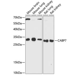 Western Blot - Anti-Calcium binding protein 7 Antibody (A89152) - Antibodies.com