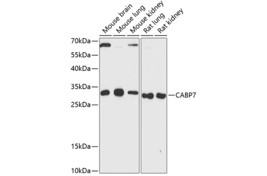 Western Blot - Anti-Calcium binding protein 7 Antibody (A89152) - Antibodies.com